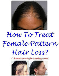Pin On Hair Loss Woman 2