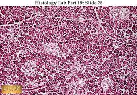 Look at the vascular perfusion of islets of langerhans. Pancreas