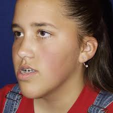 Austin Jaw Surgery (@austinjawsurgery) • Instagram photos and videos