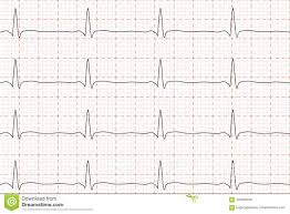 Cardiogram Of Heart Beat Ecg On Chart Paper Vector