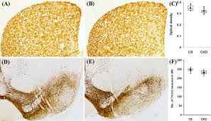 Sometimes, kidney failure is temporary and comes on sometimes, though, kidney failure happens quickly due to an unforeseen cause. Neurological Sequel Of Chronic Kidney Disease From Diminished Acetylcholinesterase Activity To Mitochondrial Dysfunctions Oxidative Stress And Inflammation In Mice Brain Scientific Reports