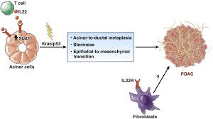 Globally pancreatic cancer is the 11th most common cancer in women and the 12th most common in men. Pancreatic Cancer Thrives On Hijacking A Homeostatic Tissue Repair Pathway Gastroenterology