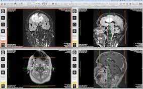 Advanced 3d dicom viewer for patients & practitioners whether you are a practitioner or a patient, you can now quickly and easily convert and view your 2d radiological scans in 3d. Open View And Read Dicom Dcm Medical Images In Mac Os X Ios With Osirix Osxdaily