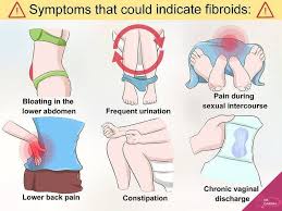 Many Of The Women Are Still Unaware Of The Fibroids Which Is Becoming The Common Problem Nowadays Just Checkout T Uterine Fibroids Fibroids Fibroids Symptoms