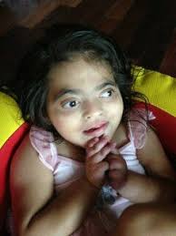 Disabled N.J. girl thrives, inspires after transplant