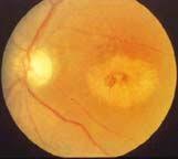 Pin On Eyes