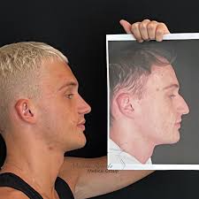 Michele Roberto Medical...