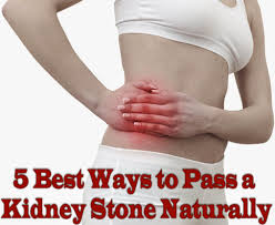 5 Best Ways To Pass A Kidney Stone Naturally Medi Hints Home Health Remedies Health Heal Health