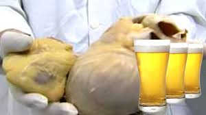 Was Passiert Wenn Man Taglich Viel Bier Trinkt Youtube