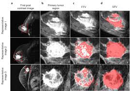 Image result for Primary Tumor Localization