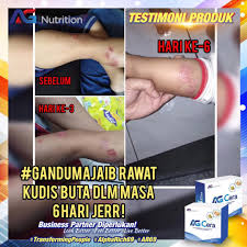 Orang yang bergaul rapat dan tinggal bersama orang yang telah dijangkiti kudis buta harus dirawat pada masa yang sama. Testimoni Ag Cera Kudis Buta Ag Nutrition