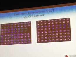 Spect Scanner Vs Pet Which Is Best Spect Scanner Daic