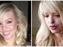 Net voor ze geëlektrocuteerd wordt in bad, stuurt Madison (14) deze foto  naar vriendin