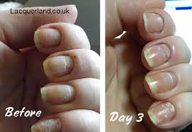 Maybe you would like to learn more about one of these? White Spots In Nails Sue S Pure Nail Oil Challenge Nail Care Hq