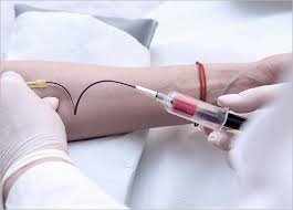 We are a subsidiary of renesas corporation. Prp Treatment Acne Hair Loss Knee Premier Clinic Kl Malaysia