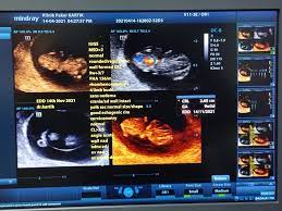 Bidang perbidanan (obstetrik) memberikan tumpuan khusus kepada kaum wanita terutamanya yang melibatkan kesihatan wanita hamil supaya mereka memahami erti kandungan sihat. Klinik Pakar Sakit Puan Ibu Mengandung Kartik Startseite Facebook