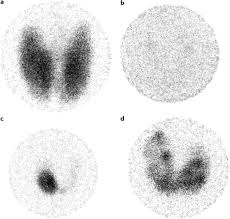 Remember, though, that not everyone with. Graves Disease Nature Reviews Disease Primers