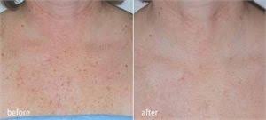 Pin On Cosmetic Services