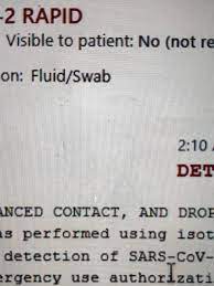 If you test positive, you may also be contacted via email or text message to see if you wish to donate blood plasma as part of the potential treatment for coronavirus. Gray Area Of Covid 19 Testing Positive Doesn T Always Mean Contagious Wsyx
