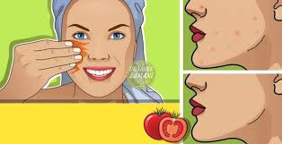 Saglikli Ve Parlak Bir Cilt Icin En Iyi Meyve Maskeleri Organik Zamani Family Guy Beauty Character