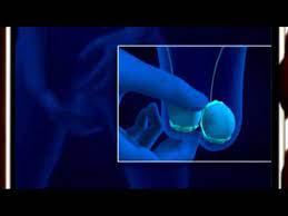 Breast cancer is the second most common cancer found in women — after skin cancer — but that doesn't mean men aren't at risk as well. Self Exam How To Youtube