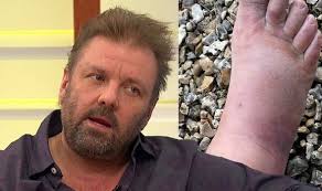 Jul 02, 2021 · martin roberts spots 'big issue' with homes under the hammer house my gran used to make it and the house used to stink for days. Nz0ha2xil5x7qm