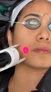 These are not your average facials! Say goodbye to , ✨Acne, ✨Ance scars,  ✨Melasma & Hyperpigmentation, ✨Fine lines & wrinkles, ✨Dullness, And hello  to healthy radiant skin. Get your glow with us🔗in ...