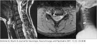 We did not find results for: Abbildung 5a C Hws Mrt