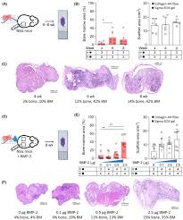 Robust acute myeloid leukemia engraftment in humanized scaffolds using  injectable biomaterials and intravenous xenotransplantation - Busa -  Molecular Oncology - Wiley Online Library