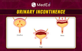 Image result for Overflow Incontinence
