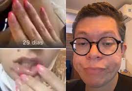 Pamella divulgou também fotos que mostram ferimentos no corpo e na boca. Yoa77msp88rfsm