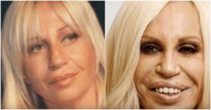 When working at a court, jeanine pirro might not need to pay attention to her appearance constantly. 13 Worst Plastic Surgery Celebrity Images Updated