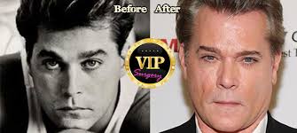 Raymond allen liotta or maybe you know him more as ray allen, the villain actor who already played in various films . Ray Liotta Plastic Surgery Before And After Photos