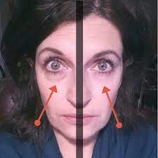 This Is Me One Eye Done One Eye Not Jeunesse Antiaging Jeunesse Instantly Ageless Instantly Ageless Ageless