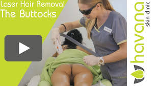 The larger the area, the higher the cost. Laser Hair Removal Buttocks Full Demo Beauty Hair Nail Skin Tutorials