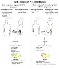 Below, we'll explain how these two types of the. Maternal And Neonatal Herpes Simplex Virus Infections Abstract Europe Pmc