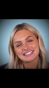 Constance Levres Avant Apres Secret Story