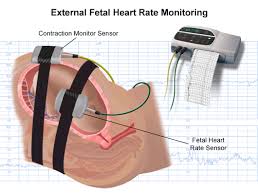 External And Internal Heart Rate Monitoring Of The Fetus