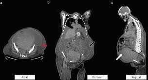 And, although less likely, cysts can also develop from cancer. The Past Present And Future Of Diagnostic Imaging In Ovarian Cancer Intechopen