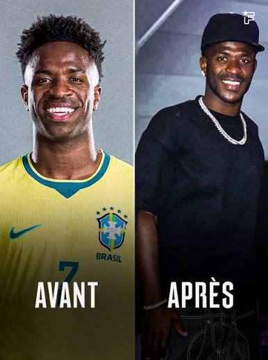 Vinicius Jr. a recours à la chirurgie esthétique : Voici le nouveau visage du footballeur madrilène