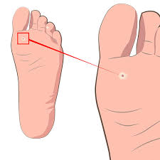 Image result for Corns