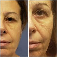 Points To Wellness, 1S132 Summit Ave, Ste 105E, Oakbrook Terrace, IL 60181,  US