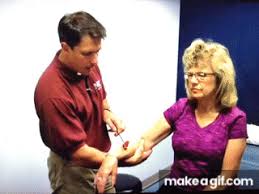 Image result for Supinator Reflex