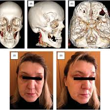 Revaz DZHINDZHIKHADZE