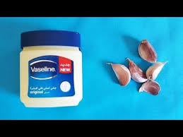 الفازلين و الثوم لانبات فراغات الشعر و الصلع من أول استعمال سريع ومذهل للغاية Youtube Vaseline Hair Treatment Beauty Care