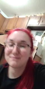 I do taxidermy and such and I was cutting up a roadkill opossum and  accidentally cut an artery