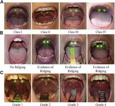 It's a simple but very helpful test to check airway restriction, and i use it in my practice every day. Cost Effective Imaging Can Determine Patients Osa Risk And Severity Eurekalert Science News