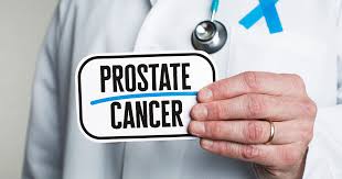 Image result for Prostate Cancer Management