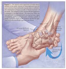 1a, 1b, 1c, 1d, 2a, 2b, 2c, 2d, 3a, 3b, 3c, 4a, 4b) is the most commonly injured group of ankle ligaments and is often associated with ligament injury elsewhere in the ankle. Managing Foot And Ankle Injuries In Athletes