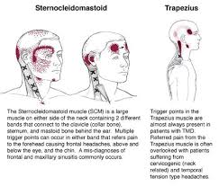 Tmj Trigger Points Medical Massage Massage Therapy Hand